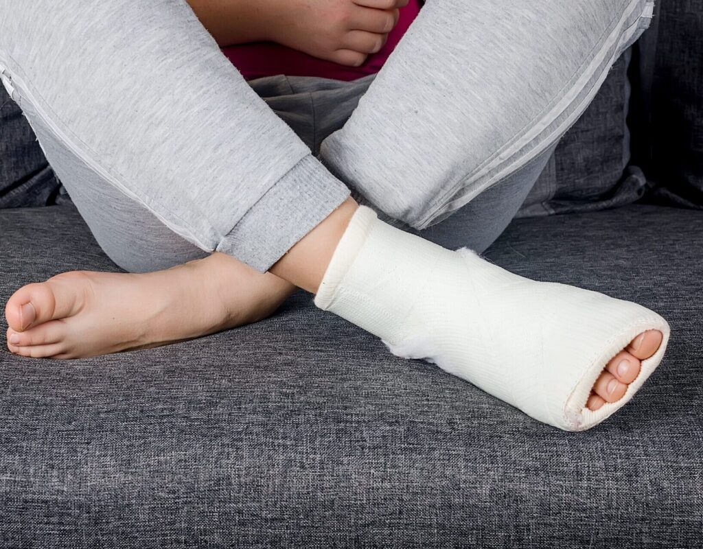 Child with Plaster bandage on leg cast and toes after injury fracture, dislocation, sprain.
