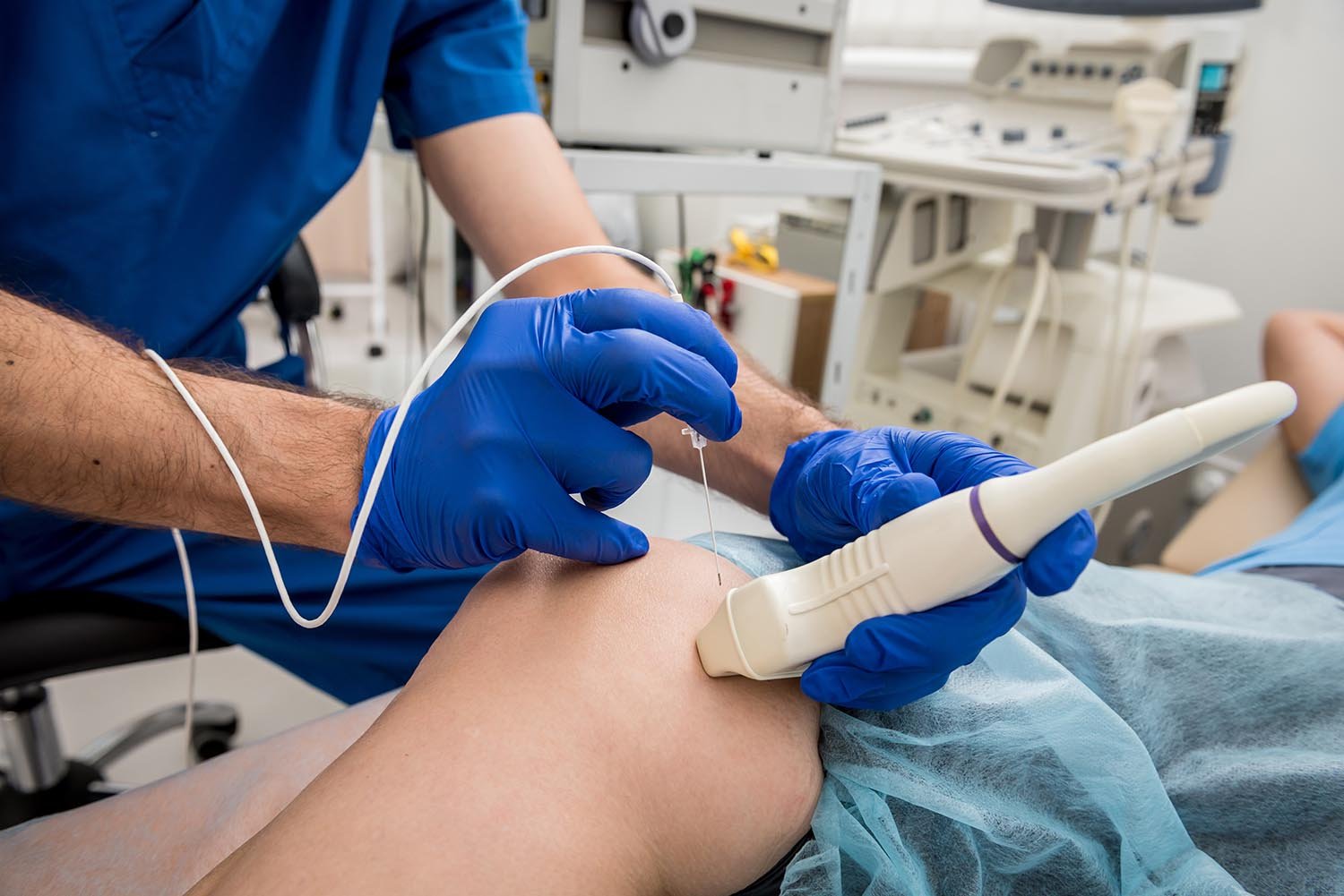 Cardiologist use tubes and ultrasound for radiofrequency catheter ablation