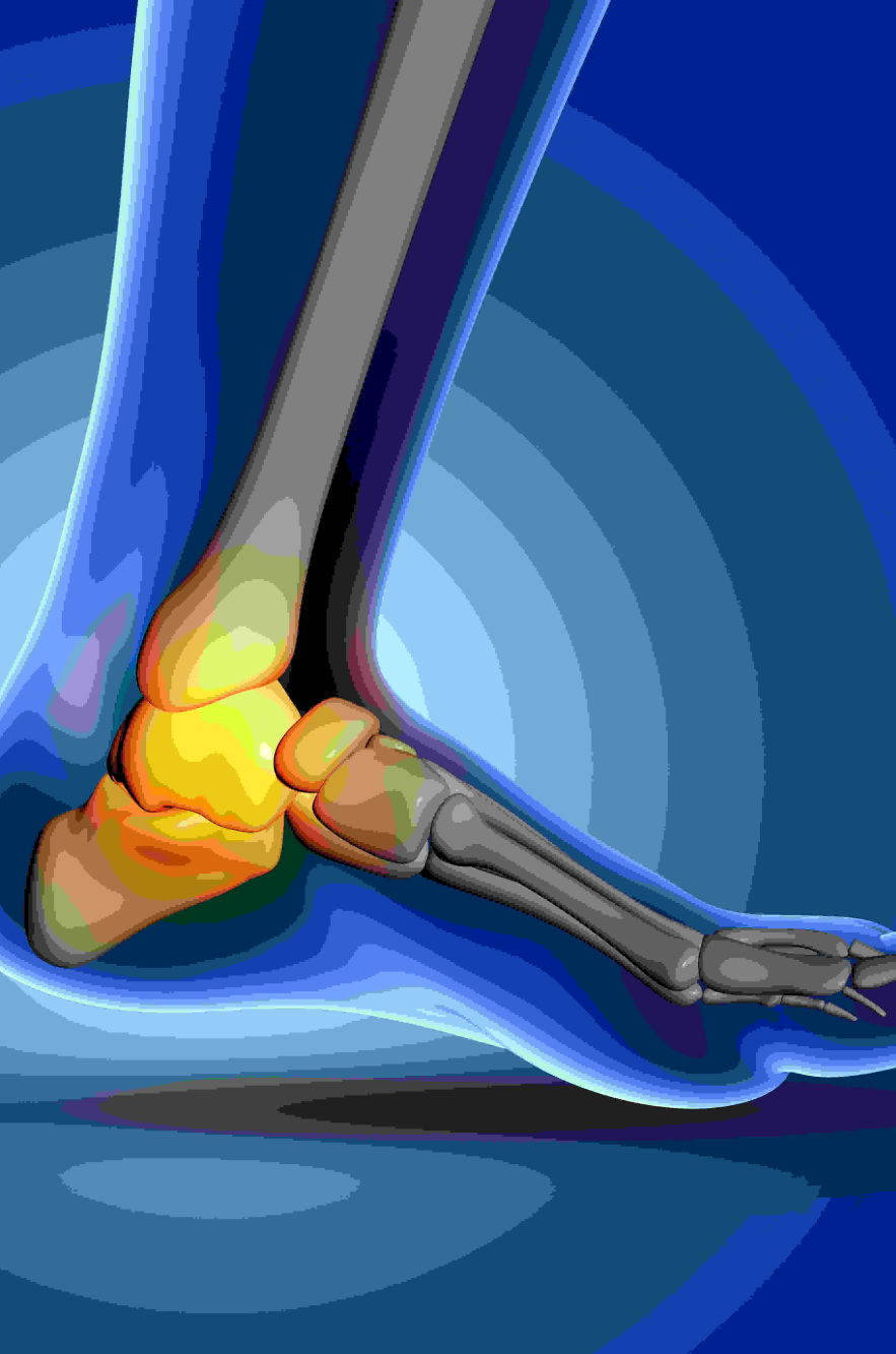 foot-joint-pain (1)